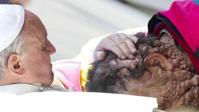 Francisco y el enfermo de tumores