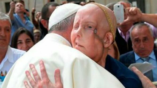 El Papa abraza a una enferma de cáncer