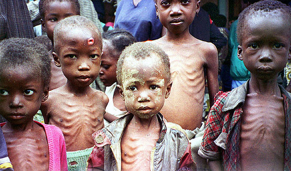 Estragos del hambre en los niños