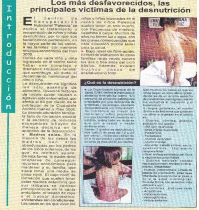 Desnutrición