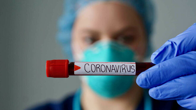 Manos unidas alerta sobre las consecuencias del coronavirus en la población más vulnerable