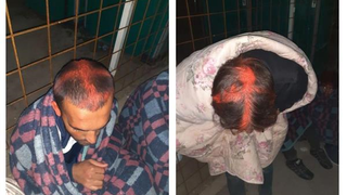 Las fotos que muestran la acción policial