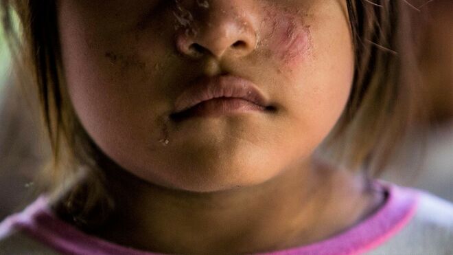 Niña indígena afectada por el derrame de petroleo. Foto Ivan Castaneira.