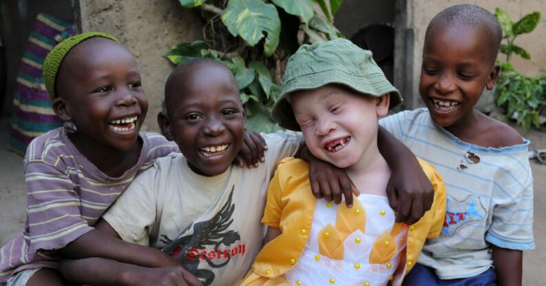 albinos-africa-2