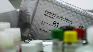 Pruebas diagnósticas