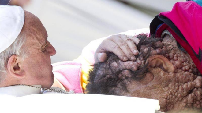 El Papa consuela a un enfermo