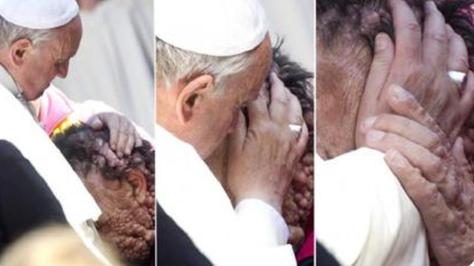 El Papa y el enfermo