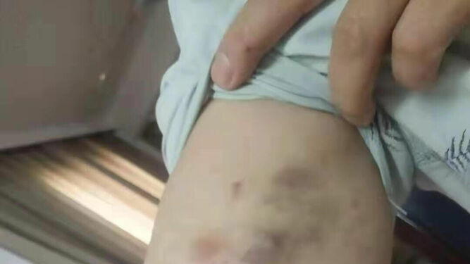 Heridas contra un sacerdote chino