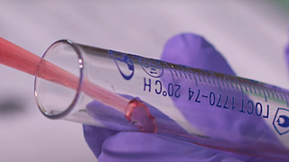 La investigación abre la puerta a diseñar nuevos sistemas de diagnóstico precoz.