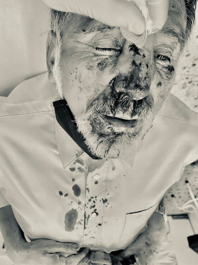 Mateo Calvillo Paz agredido por sicarios