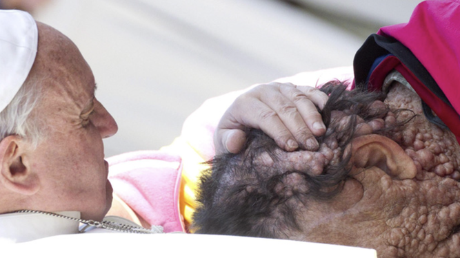 El Papa y el enfermo