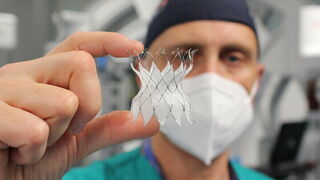 El pionero ‘stent’