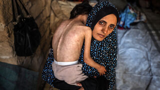 Me duele el telediario