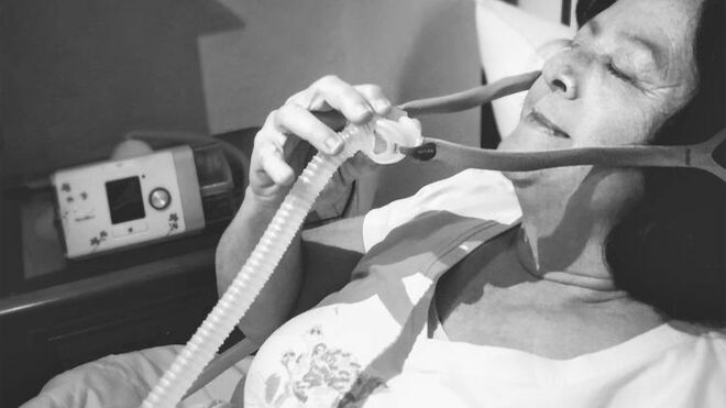 Apnea obstructiva del sueño